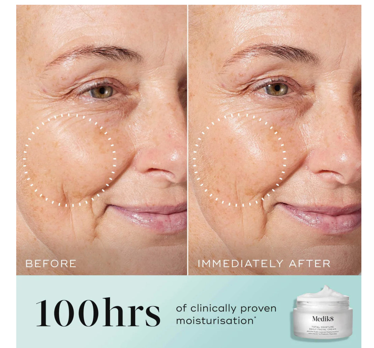 Moisturiser | Total Moisture Daily Cream - Medik8