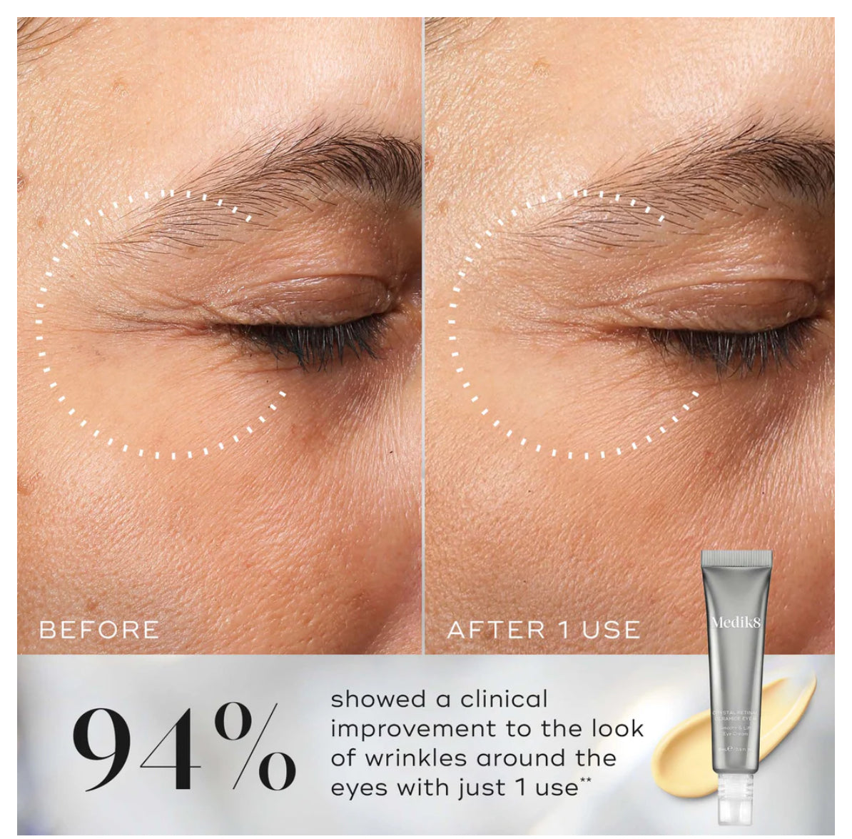 Eye Cream | CRYSTAL RETINAL CERAMIDE EYE 10 - Medik8
