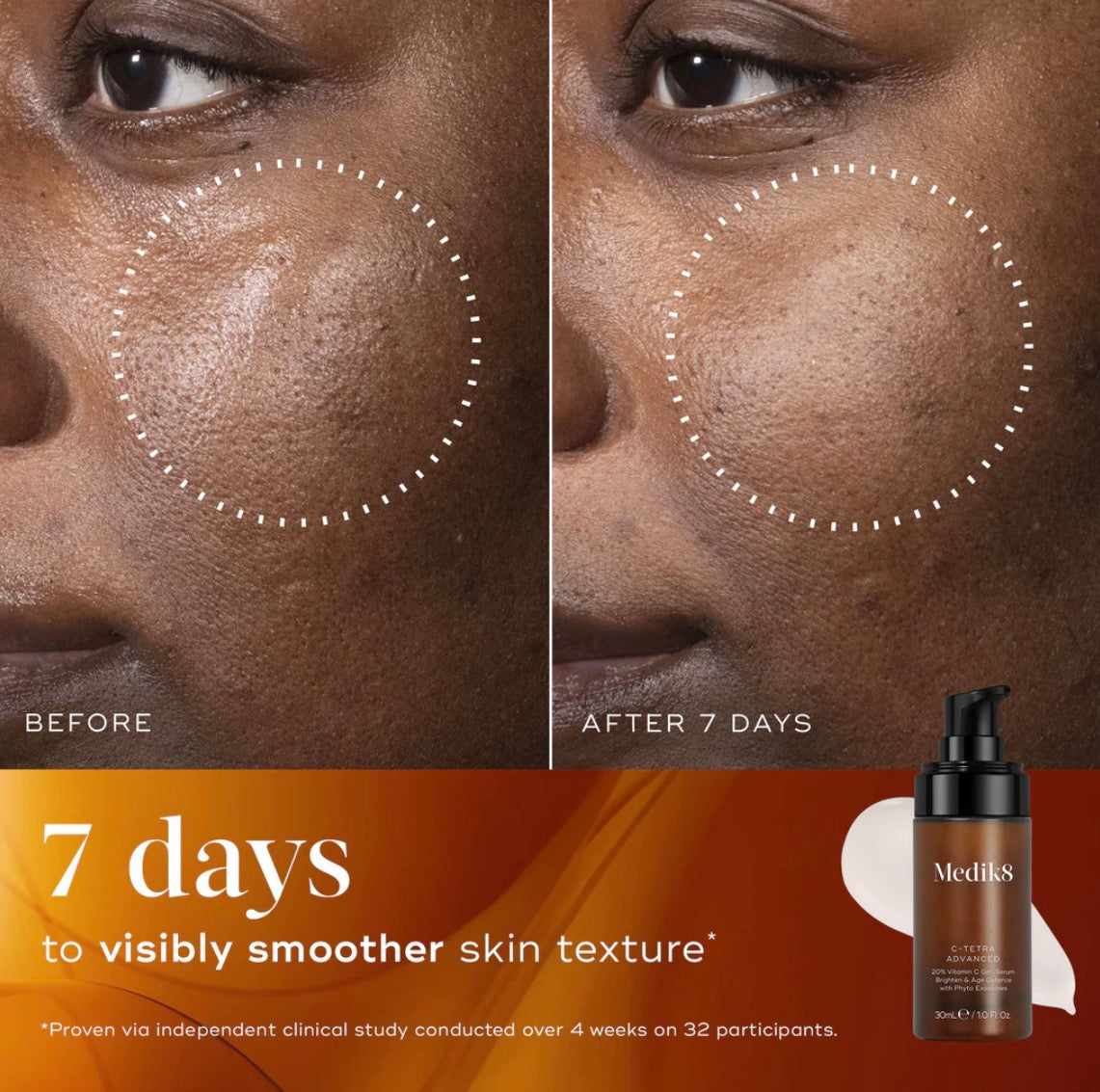 Serum | C Tetra Advanced - Medik8