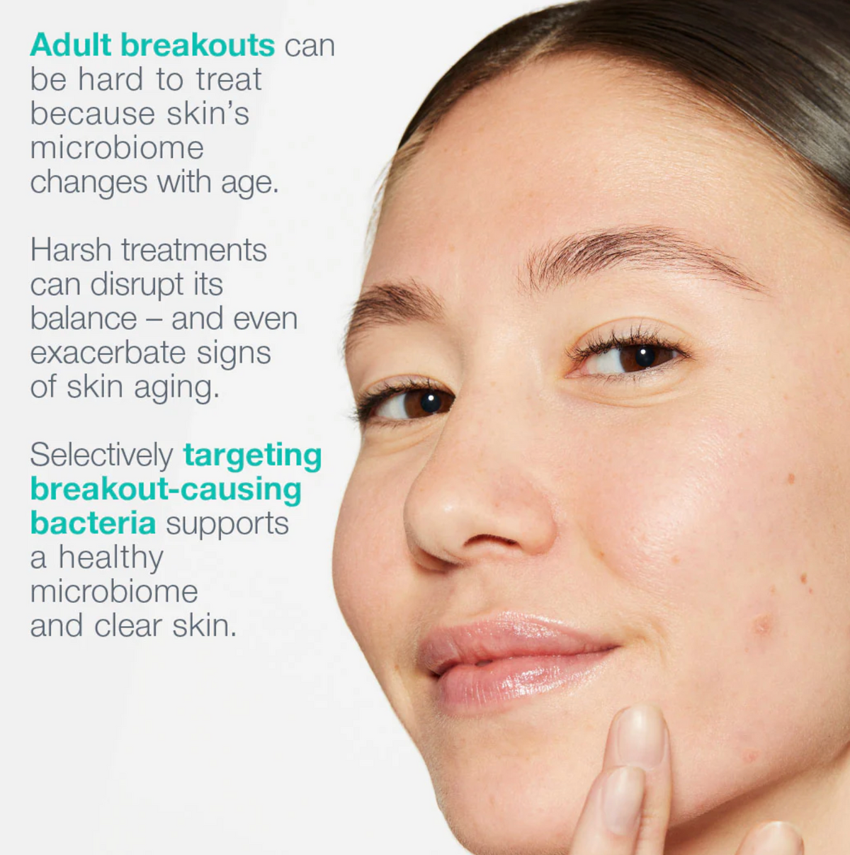 Moisturiser | Breakout Biotic Moisturiser - Active Clearing - Dermalogica